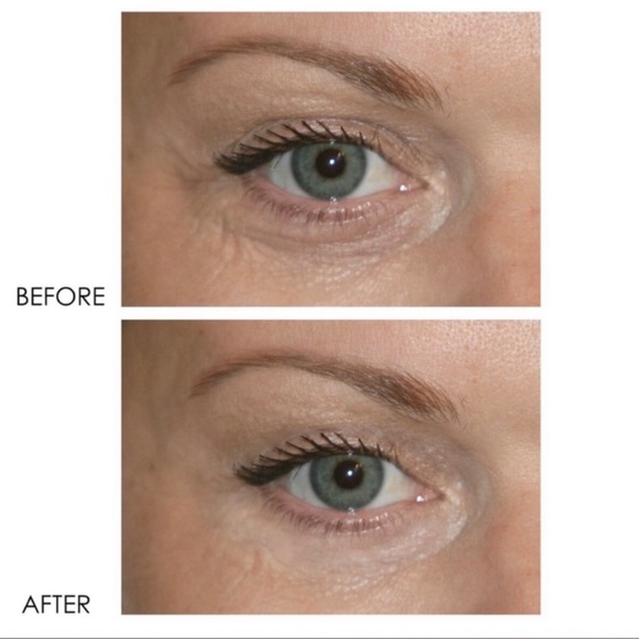 🔆 Dermelect Revitalite Pro Dark Circle Corrector ➿ - Picture 7 of 8